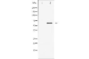 Western blot analysis of Elk1 expression in heatshock treated HeLa whole cell lysates,The lane on the left is treated with the antigen-specific peptide. (ELK1 Antikörper  (C-Term))