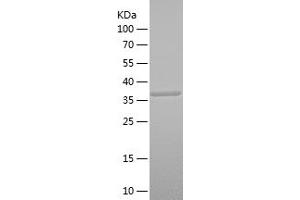 Western Blotting (WB) image for serine Peptidase Inhibitor, Kunitz Type 1 (SPINT1) (AA 130-249) protein (His-IF2DI Tag) (ABIN7125038) (SPINT1 Protein (AA 130-249) (His-IF2DI Tag))