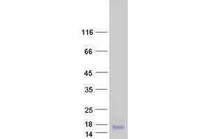 Validation with Western Blot (MT1E Protein (Myc-DYKDDDDK Tag))