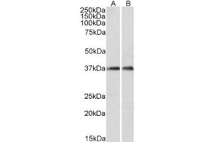 Western Blot (0. (ARPC1A Antikörper  (C-Term))