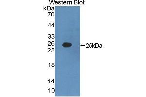 Figure. (IFNA2 Antikörper  (AA 24-192))