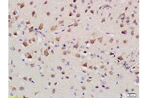 Formalin-fixed and paraffin embedded mouse brain labeled with Anti-SLC4A4 Polyclonal Antibody, Unconjugated at 1:400 followed by conjugation to the secondary antibody and DAB staining (kNBC (AA 1-100) Antikörper)