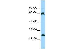 Host: Rabbit Target Name: FARSB Sample Type: 293T Whole Cell lysates Antibody Dilution: 1.