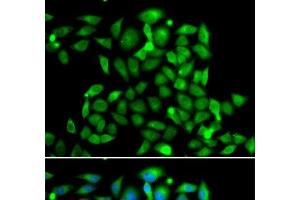 Immunofluorescence analysis of A549 cells using CLASP1 Polyclonal Antibody (CLASP1 Antikörper)