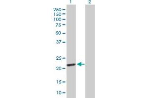 Western Blot analysis of EXOSC1 expression in transfected 293T cell line by EXOSC1 MaxPab polyclonal antibody. (EXOSC1 Antikörper  (AA 1-195))