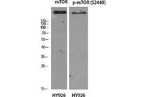 Western Blot (WB) analysis of specific cells using mTOR Polyclonal Antibody. (MTOR Antikörper  (Ser396))