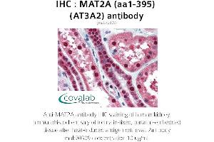Image no. 3 for anti-Methionine Adenosyltransferase II, alpha (MAT2A) (AA 1-395) antibody (ABIN1724355) (MAT2A Antikörper  (AA 1-395))