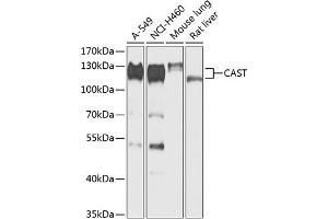 Western blot analysis of extracts of various cell lines, using CAST antibody (ABIN6133634, ABIN6137983, ABIN6137985 and ABIN6217769) at 1:1000 dilution. (Calpastatin Antikörper  (AA 550-650))