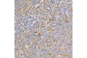 Immunohistochemistry of paraffin-embedded human tonsil using GSDMD (Full Length+N terminal) Rabbit pAb  at dilution of 1:100 (40x lens). (GSDMD Antikörper)