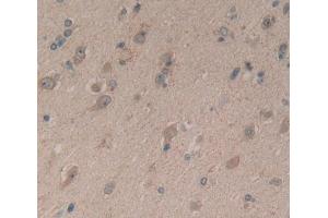 Used in DAB staining on fromalin fixed paraffin- embedded brain tissue (Complexin 1 Antikörper  (AA 1-134))