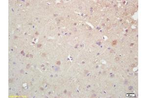 Formalin-fixed and paraffin embedded rat brain labeled with Rabbit Anti KIF5A/NKHC1 Polyclonal Antibody, Unconjugated (ABIN1387674) at 1:200 followed by conjugation to the secondary antibody and DAB staining (K5A/ NKHC1 (AA 201-300) Antikörper)