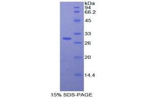 SDS-PAGE (SDS) image for Acid Phosphatase 5, Tartrate Resistant (ACP5) (AA 74-321) protein (His tag) (ABIN1879457) (ACP5 Protein (AA 74-321) (His tag))