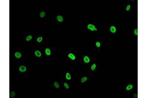 Immunofluorescence staining of Hela cells (treated with 30mM sodium butyrate for 4h) with ABIN7139195 at 1:2. (HIST1H2AG Antikörper  (acLys74))