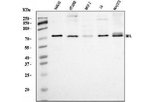 Western blot analysis of SnoN/SNO/SKIL using anti-SnoN/SNO/SKIL antibody (ABIN7599455).