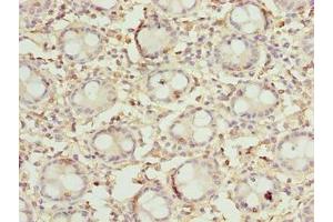 Immunohistochemistry of paraffin-embedded human colon tissue using ABIN7149683 at dilution of 1:100 (DENND5A Antikörper  (AA 1-300))