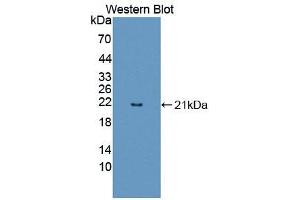 Western blot analysis of the recombinant protein. (FAM3B Antikörper  (AA 30-187))