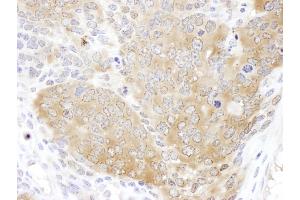 anti-Chaperonin Containing TCP1, Subunit 5 (Epsilon) (CCT5) (AA 100-150) antibody