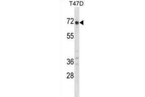 Western Blotting (WB) image for anti-Glypican 2 (GPC2) antibody (ABIN2998770) (GPC2 Antikörper)