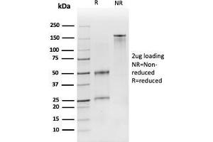 SDS-PAGE Analysis Purified CD19 Monospecific Mouse Monoclonal Antibody (CD19/3116). (CD19 Antikörper  (AA 96-281))