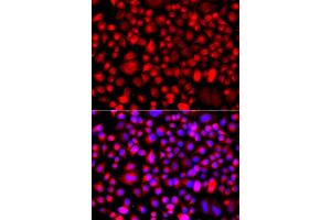 Immunofluorescence analysis of A549 cell using ALG1 antibody. (ALG1 Antikörper)