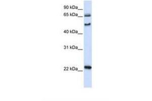 Image no. 1 for anti-UNC Homeobox (UNCX) (AA 74-123) antibody (ABIN6739205) (UNCX Antikörper  (AA 74-123))