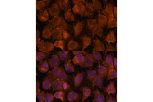 Immunofluorescence analysis of C6 cells using NXN antibody (ABIN7269054) at dilution of 1:100. (NXN Antikörper  (AA 100-280))
