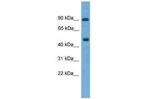 WB Suggested Anti-MED25 Antibody Titration:  0. (MED25 Antikörper  (N-Term))