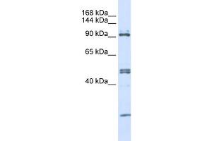 WB Suggested Anti-AARS Antibody Titration:  0. (AARS Antikörper  (N-Term))