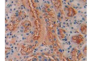 IHC-P analysis of Mouse Kidney Tissue, with DAB staining. (BMP5 Antikörper  (AA 201-314))
