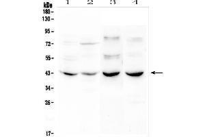 Western blot analysis of NPBWR1 using anti-NPBWR1 antibody (ABIN6719427).