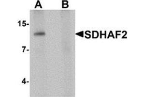 Western blot analysis of SDHAF2 in rat liver tissue lysate with SDHAF2 antibody at 1 ug/mL in (A) the absence and (B) the presence of blocking peptide.
