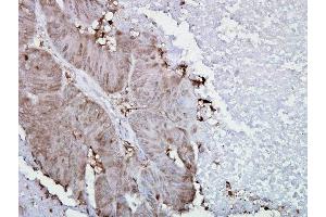 Immunohistochemistry (IHC) image for anti-Heat Shock Protein 90kDa alpha (Cytosolic), Class A Member 2 (HSP90AA2) (AA 604-731) antibody (ABIN361714)