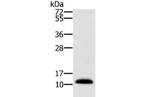 Western Blot analysis of Human prostate tissue using MSMB Polyclonal Antibody at dilution of 1:250 (MSMB Antikörper)