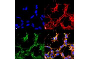 Immunocytochemistry/Immunofluorescence analysis using Rabbit Anti-HSP70 Acetyl Lys77 Polyclonal Antibody (ABIN5650763). (HSP70 Antikörper  (acLys77) (Atto 594))