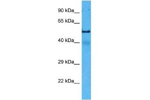 Host:  Rat  Target Name:  TUBA1A  Sample Tissue:  Rat Skeletal Muscle  Antibody Dilution:  1ug/ml (TUBA4A Antikörper  (Middle Region))