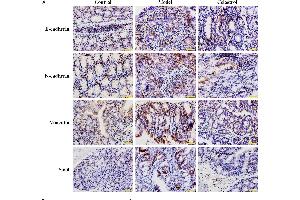 Effects of celastrol (2 mg/kg) on the expression levels of EMT-related proteins in AOM/DSS-treated mice. (SNAI1, SNAI2, SNAI3 (AA 188-264) Antikörper)