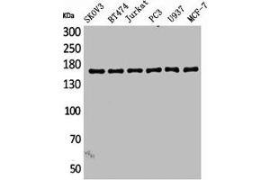 Western Blot analysis of SKOV3 BT474 Jurkat PC-3 U937 MCF7 cells using SCP-2 Polyclonal Antibody (SYCP2 Antikörper  (Internal Region))