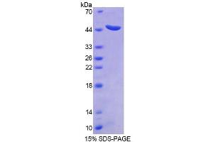 SDS-PAGE analysis of Human STAM2 Protein.