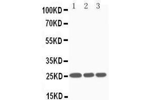 Western Blotting (WB) image for anti-Suppressor of Cytokine Signaling 3 (SOCS3) (AA 71-85), (Middle Region) antibody (ABIN3044272)