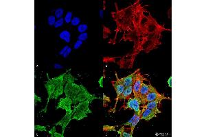 Immunocytochemistry/Immunofluorescence analysis using Mouse Anti-ASIC1 Monoclonal Antibody, Clone S271-44 . (ASIC1 Antikörper  (AA 460-526))