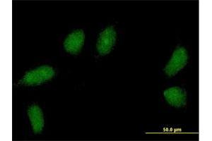 Immunofluorescence (IF) image for anti-Transcription Elongation Factor A (SII) N-Terminal and Central Domain Containing 2 (TCEANC2) (AA 1-208) antibody (ABIN530587)
