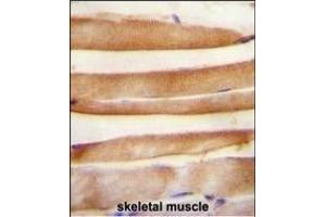 Immunohistochemistry (Paraffin-embedded Sections) (IHC (p)) image for anti-ARV1 Homolog (ARV1) (AA 23-51), (N-Term) antibody (ABIN654612)