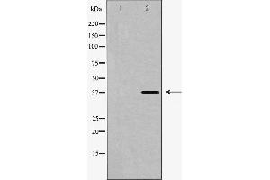 Western blot analysis of SUCNR1 expression in HUVEC cells. (SUCNR1 Antikörper  (Internal Region))