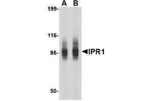 Western blot analysis of IPR1 in SW480 cell lysate with IPR1 antibody at (A) 1 and (B) 2 μg/ml. (SP110 Antikörper  (N-Term))