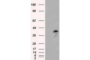 Western Blotting (WB) image for anti-Induced Myeloid Leukemia Cell Differentiation Protein Mcl-1 (MCL1) antibody (ABIN1499337) (MCL-1 Antikörper)