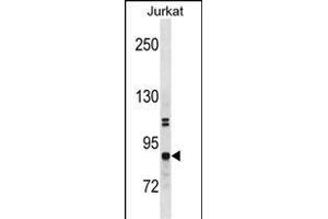 CHUK Antibody (N-term) (ABIN1881203 and ABIN2838746) western blot analysis in Jurkat cell line lysates (35 μg/lane). (IKK alpha Antikörper  (N-Term))