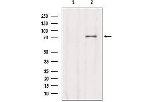 Western blot analysis of extracts from Sp2/0, using CCDC93 Antibody. (CCDC93 Antikörper  (C-Term))