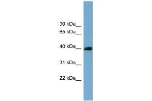 WB Suggested Anti-CXorf9 Antibody Titration: 0. (SASH3 Antikörper  (N-Term))