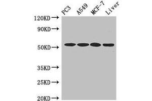 Western Blot Positive WB detected in: PC-3 whole cell lysate, A549 whole cell lysate, MCF-7 whole cell lysate, , Mouse liver tissue All lanes: IRF6 antibody at 4 μg/mL Secondary Goat polyclonal to rabbit IgG at 1/50000 dilution Predicted band size: 54, 42 kDa Observed band size: 54 kDa (IRF6 Antikörper  (AA 43-285))