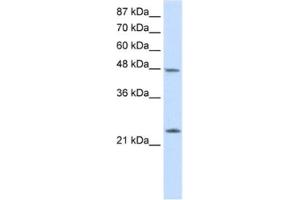 Western Blotting (WB) image for anti-Chromobox Homolog 6 (CBX6) antibody (ABIN2461846) (CBX6 Antikörper)